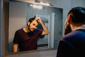 a-worried-young-white-man-looks-at-himself-in-the-mirror-and-inspects-his-premature-receding-hairline-attractive-caucasian-male-adult-in-his-30s-concerned-about-losing-hair-male-pattern-baldness-stockpack-adobe-stock-300x200.jpg